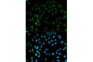 Immunofluorescence analysis of MCF-7 cells using TFPI antibody. (TFPI 抗体  (AA 29-224))