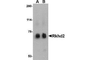 Western Blotting (WB) image for anti-Mex-3 Homolog C (C. Elegans) (MEX3C) (C-Term) antibody (ABIN1030621) (MEX3C 抗体  (C-Term))