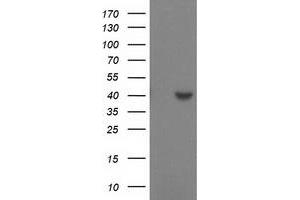 Western Blotting (WB) image for anti-Sulfotransferase Family, Cytosolic, 1C, Member 2 (SULT1C2) antibody (ABIN1501231) (SULT1C2 抗体)