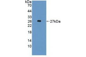 Detection of Recombinant FGF19, Human using Polyclonal Antibody to Fibroblast Growth Factor 19 (FGF19) (FGF19 抗体  (AA 4-216))