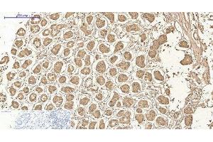Immunohistochemistry of paraffin-embedded Human stomach tissue using AMACR Monoclonal Antibody at dilution of 1:200. (AMACR 抗体)
