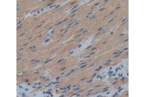 Detection of ACTC1 in Human Rectum Tissue using Anti-Actin Alpha 1, Cardiac Muscle (ACTC1) Polyclonal Antibody (ACTC1 抗体  (AA 156-368))