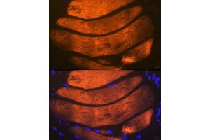 Immunofluorescence analysis of mouse bone marrow using Troponin I2 (Troponin I2 (TNNI2)) Rabbit mAb (ABIN1679777, ABIN7101727, ABIN7101728 and ABIN7101729) at dilution of 1:100 (40x lens). (TNNI2 抗体)
