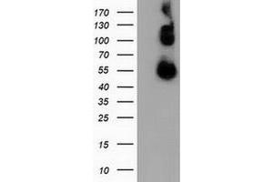 Western Blotting (WB) image for anti-Calcium Binding and Coiled-Coil Domain 2 (CALCOCO2) antibody (ABIN1497077) (CALCOCO2 抗体)