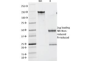 SDS-PAGE Analysis Purified Lambda Light Chain Monoclonal Antibody (N10/2). (IgL 抗体)