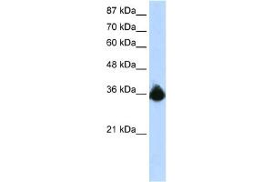 WB Suggested Anti-PTBP2 Antibody Titration:  1. (PTBP2 抗体  (N-Term))