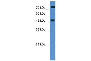 WB Suggested Anti-VDR AntibodyTitration: 1. (Vitamin D Receptor 抗体  (N-Term))
