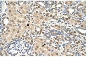 Rabbit Anti-TMEM30A Antibody  Paraffin Embedded Tissue: Human Kidney Cellular Data: Epithelial cells of renal tubule Antibody Concentration: 4. (TMEM30A 抗体  (Middle Region))