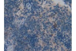 Immunohistochemistry (IHC) image for anti-Vasoactive Intestinal Peptide (Vip) (AA 34-157) antibody (ABIN7431701)