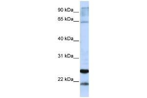 WB Suggested Anti-GSTA4 Antibody Titration:  0. (GSTA4 抗体  (C-Term))