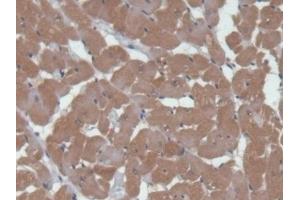 Immunohistochemistry (IHC) image for anti-Calcium/calmodulin-Dependent Protein Kinase II alpha (CAMK2A) (AA 1-478) antibody (ABIN7435484)