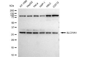 Western blotting analysis using SLC31A1 antibody (ABIN7800396).
