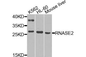 Western blot analysis of extracts of various cells, using RNASE2 antibody. (RNASE2 抗体)