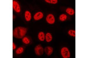 ABIN6268709 staining lovo cells by ICC/IF. (Lamin B 抗体)