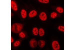 ABIN6268709 staining lovo cells by ICC/IF. (Lamin B 抗体)