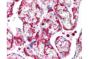 Anti-INHA / Inhibin Alpha antibody IHC of human placenta. (Inhibin alpha 抗体)