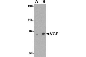 Western blot analysis of VGF in human brain tissue lysate with this product at (A) 0. (VGF 抗体  (C-Term))