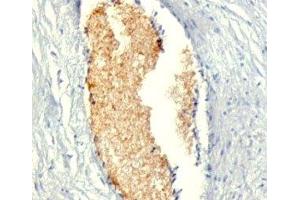 Formalin-fixed, paraffin-embedded human placenta stained with AMPD3 antibody (AMPD3/901) (AMPD3 抗体)
