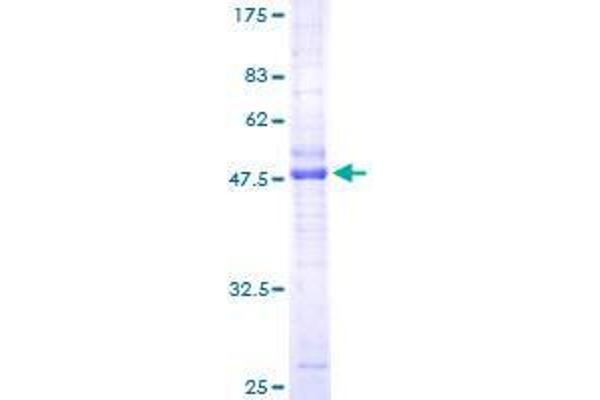 CMTM3 Protein (AA 1-182) (GST tag)