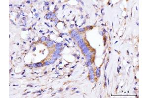 IHC analysis of GIGYF2 using anti-GIGYF2 antibody (ABIN7601679). (GIGYF2 抗体  (AA 413-1299))
