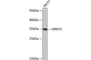 Western blot analysis of extracts of MCF-7 cells, using SPINT2 Antibody (ABIN6132838, ABIN6148361, ABIN6148362 and ABIN6222480) at 1:1000 dilution. (SPINT2 抗体  (AA 28-197))