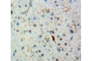 IHC-P analysis of Brain tissue, with DAB staining. (BCL9 抗体  (AA 1118-1327))
