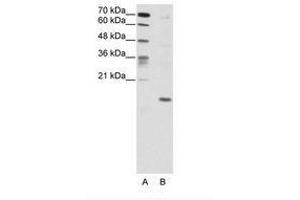 Image no. 1 for anti-Double Homeobox 5 (DUX5) (C-Term) antibody (ABIN203019) (DUX5 抗体  (C-Term))