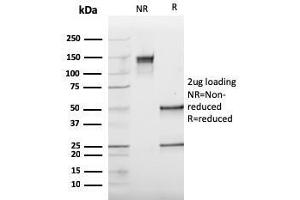 SDS-PAGE Analysis Purified Cathepsin K Mouse Monoclonal Antibody (CTSK/2793). (Cathepsin K 抗体  (AA 163-274))