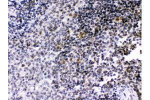Anti- RAG2 Picoband antibody, IHC(P) IHC(P): Rat Spleen Tissue (RAG2 抗体  (C-Term))