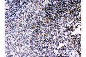 Anti- RAG2 Picoband antibody, IHC(P) IHC(P): Rat Spleen Tissue