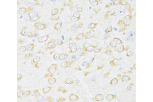 Immunohistochemistry of paraffin-embedded Mouse brain using DDX3Y Polyclonal Antibody at dilution of 1:100 (40x lens). (DDX3Y 抗体)