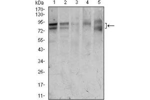 Western Blotting (WB) image for anti-Forkhead Box P1 (FOXP1) (AA 481-677) antibody (ABIN1845854) (FOXP1 抗体  (AA 481-677))