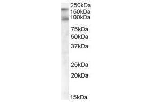 Image no. 2 for anti-CUB Domain Containing Protein 1 (CDCP1) (C-Term), (Isoform 1) antibody (ABIN374144) (CDCP1 抗体  (C-Term, Isoform 1))