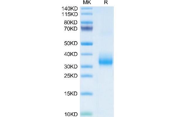 OLR1 Protein (AA 61-273) (His tag)