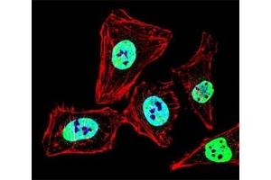 Fluorescent confocal image of HeLa cell stained with HDAC2 antibody at 1:25.