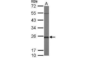 WB Image Sample (50 ug of whole cell lysate) A: Mouse brain 12% SDS PAGE antibody diluted at 1:1000 (GLO1 抗体)
