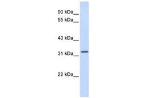 Image no. 1 for anti-Aprataxin (APTX) (AA 108-157) antibody (ABIN6742328)