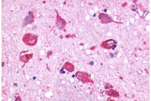 Anti-GPR150 antibody  ABIN1048734 IHC staining of human brain, neurons and glia. (GPR150 抗体  (N-Term))