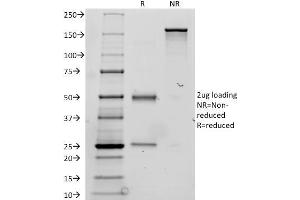 SDS-PAGE Analysis Purified Thyroglobulin Mouse Monoclonal Antibody (TGB24). (Thyroglobulin 抗体)