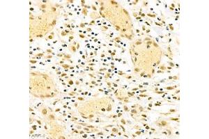 Immunohistochemistry (Paraffin-embedded Sections) (IHC (p)) image for anti-Poly A Binding Protein Nuclear 1 (PABPN1) antibody (ABIN7075116)