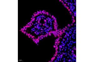 Immunofluorescence of paraffin embedded rat uterus using Skar (ABIN7074970) at dilution of 1:950 (400x lens) (p46 抗体)