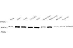 Western blot analysis of SMEK2 (ABIN7074520),at dilution of 1: 3000 (SMEK2 抗体)