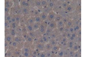 Detection of BPI in Mouse Liver Tissue using Polyclonal Antibody to Bactericidal/Permeability Increasing Protein (BPI)