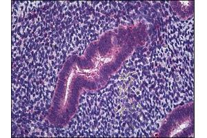 Human Uterus, Endometrium: Formalin-Fixed, Paraffin-Embedded (FFPE) (IFITM1 抗体)