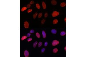 Immunofluorescence analysis of U-2 OS cells using SUN2 antibody (ABIN7270136) at dilution of 1:100. (SUN2 抗体)