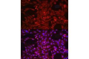 Immunofluorescence analysis of PC-12 cells using  Rabbit pAb (ABIN3015338, ABIN3015339, ABIN5663782 and ABIN6213995) at dilution of 1:50 (40x lens). (ADAM17 抗体  (C-Term))