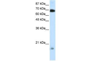 WB Suggested Anti-TRIM32 Antibody Titration: 0. (TRIM32 抗体  (C-Term))