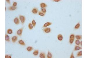 Immunocytochemistry analysis of ABIN7139181 diluted at 1:20 and staining in Hela cells (treated with 30mM sodium butyrate for 4h) performed on a Leica BondTM system. (H2AFZ 抗体  (acLys4))