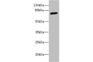 Western blot All lanes: SORBS3 antibody at 8 μg/mL + HepG2 whole cell lysate Secondary Goat polyclonal to rabbit IgG at 1/10000 dilution Predicted band size: 76, 37 kDa Observed band size: 76 kDa