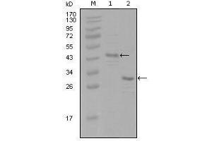 Western blot analysis using ESR1 mouse mAb against truncated Trx-ESR1 recombinant protein (1) and truncated ESR1(aa130-339)-His recombinant protein (2). (Estrogen Receptor alpha 抗体  (AA 130-339))